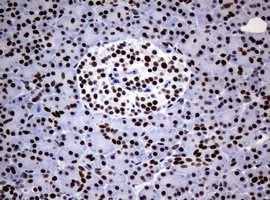 NBN Antibody in Immunohistochemistry (Paraffin) (IHC (P))