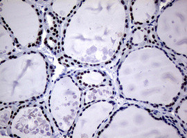 NBN Antibody in Immunohistochemistry (Paraffin) (IHC (P))