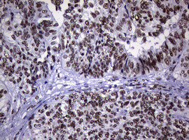 NBN Antibody in Immunohistochemistry (Paraffin) (IHC (P))