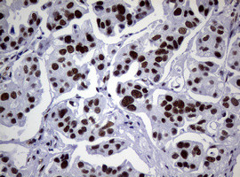 NBN Antibody in Immunohistochemistry (Paraffin) (IHC (P))