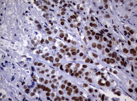 NBN Antibody in Immunohistochemistry (Paraffin) (IHC (P))