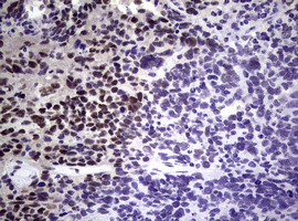 NBN Antibody in Immunohistochemistry (Paraffin) (IHC (P))