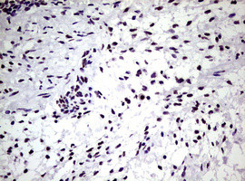 NBN Antibody in Immunohistochemistry (Paraffin) (IHC (P))