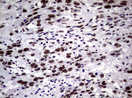 NBN Antibody in Immunohistochemistry (Paraffin) (IHC (P))