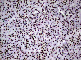 NBN Antibody in Immunohistochemistry (Paraffin) (IHC (P))