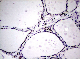 NBN Antibody in Immunohistochemistry (Paraffin) (IHC (P))