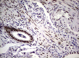 NBN Antibody in Immunohistochemistry (Paraffin) (IHC (P))