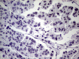 NBN Antibody in Immunohistochemistry (Paraffin) (IHC (P))