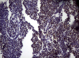 NBN Antibody in Immunohistochemistry (Paraffin) (IHC (P))