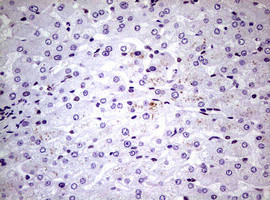 NBN Antibody in Immunohistochemistry (Paraffin) (IHC (P))