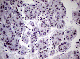 NBN Antibody in Immunohistochemistry (Paraffin) (IHC (P))