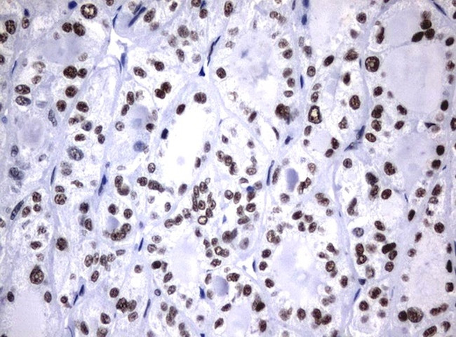 NBN Antibody in Immunohistochemistry (Paraffin) (IHC (P))