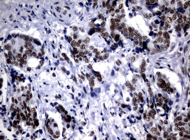 NBN Antibody in Immunohistochemistry (Paraffin) (IHC (P))