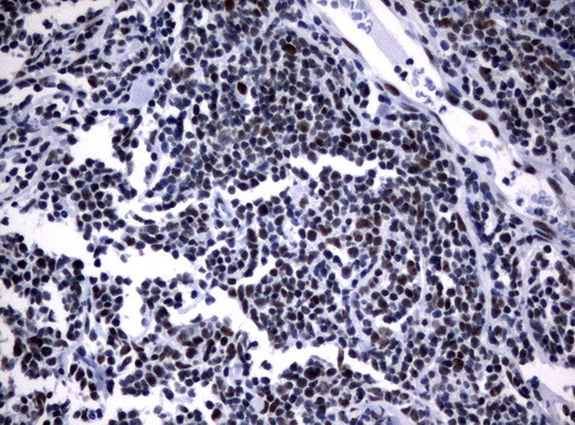 NBN Antibody in Immunohistochemistry (Paraffin) (IHC (P))