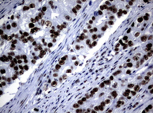 NBN Antibody in Immunohistochemistry (Paraffin) (IHC (P))