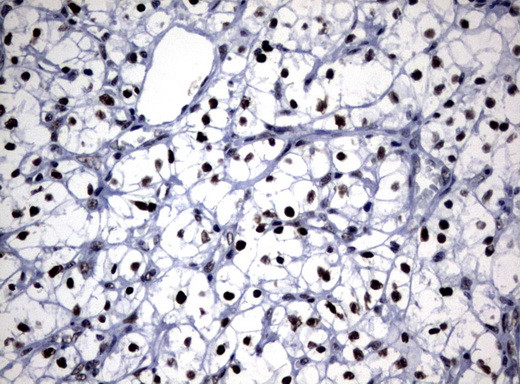 NBN Antibody in Immunohistochemistry (Paraffin) (IHC (P))