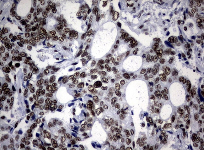 NBN Antibody in Immunohistochemistry (Paraffin) (IHC (P))