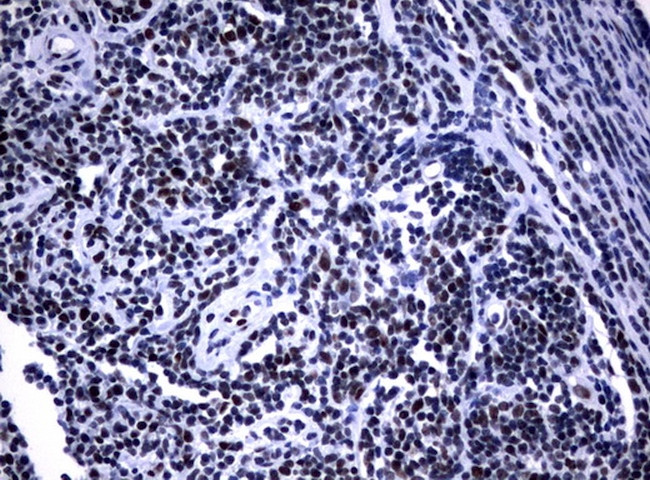 NBN Antibody in Immunohistochemistry (Paraffin) (IHC (P))