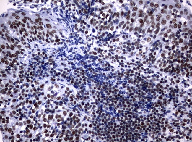 NBN Antibody in Immunohistochemistry (Paraffin) (IHC (P))