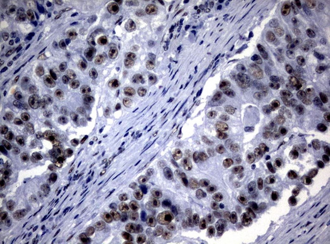 NBN Antibody in Immunohistochemistry (Paraffin) (IHC (P))