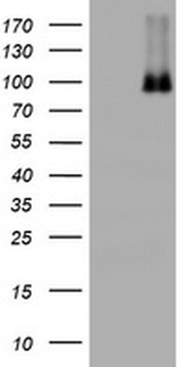 NBN Antibody in Western Blot (WB)