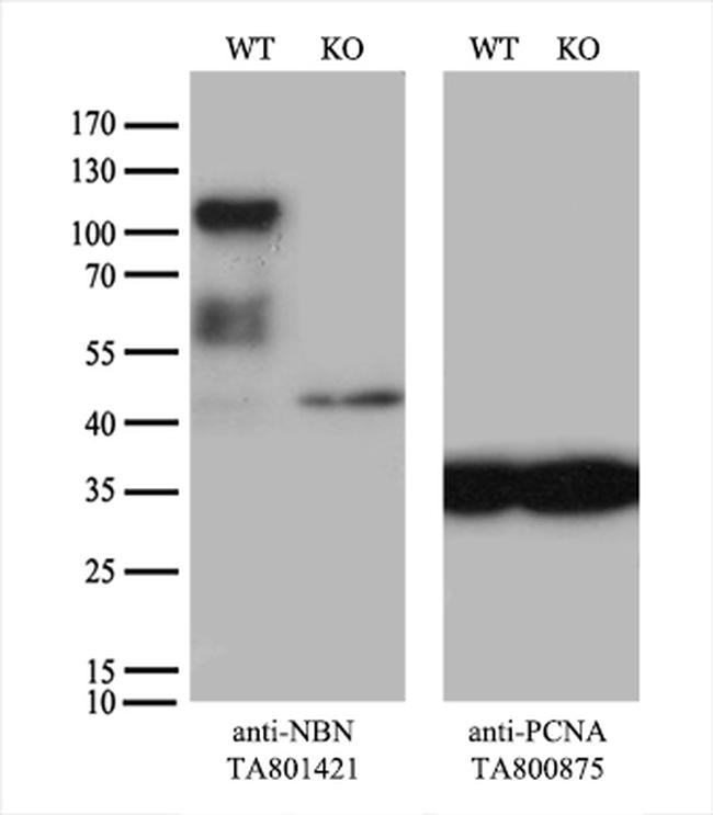 NBN Antibody in Western Blot (WB)