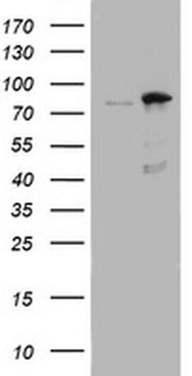 NBN Antibody in Western Blot (WB)