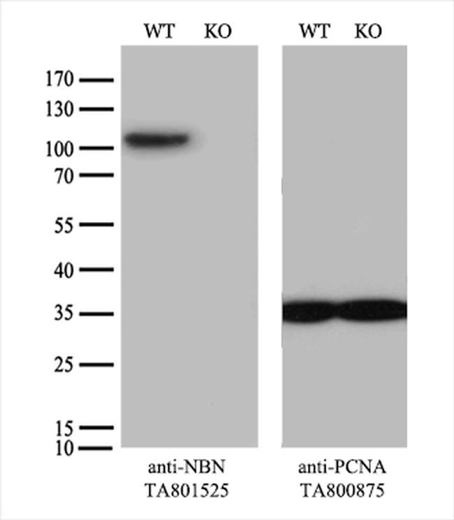 NBN Antibody in Western Blot (WB)