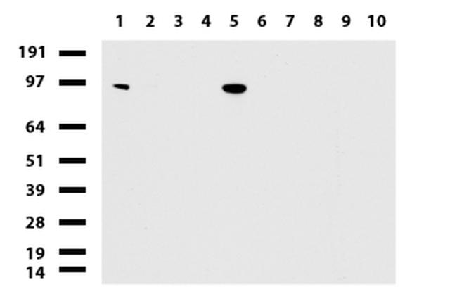 NBN Antibody in Western Blot (WB)