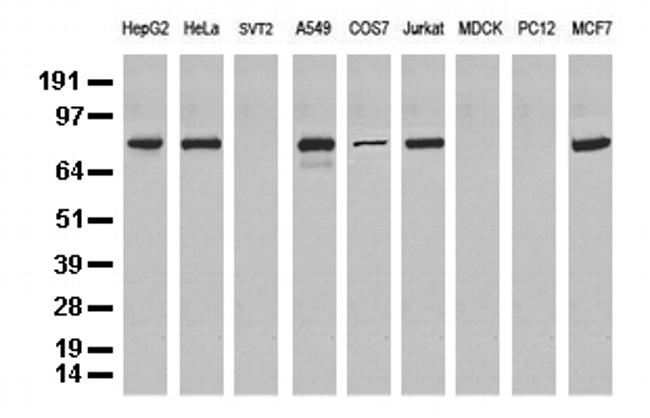 NBN Antibody in Western Blot (WB)