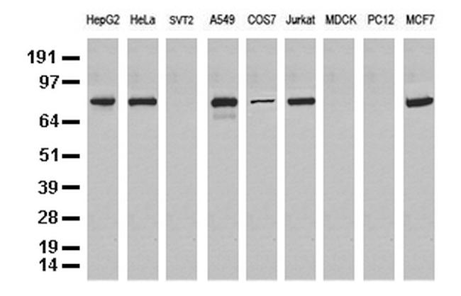 NBN Antibody in Western Blot (WB)