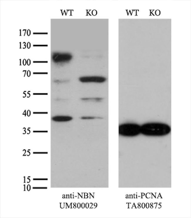 NBN Antibody in Western Blot (WB)