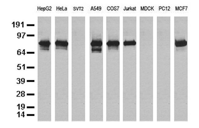 NBN Antibody in Western Blot (WB)