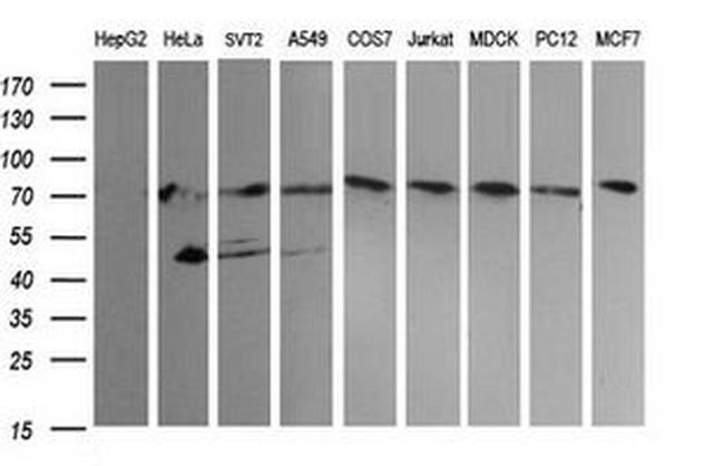 NCAM1 Antibody in Western Blot (WB)