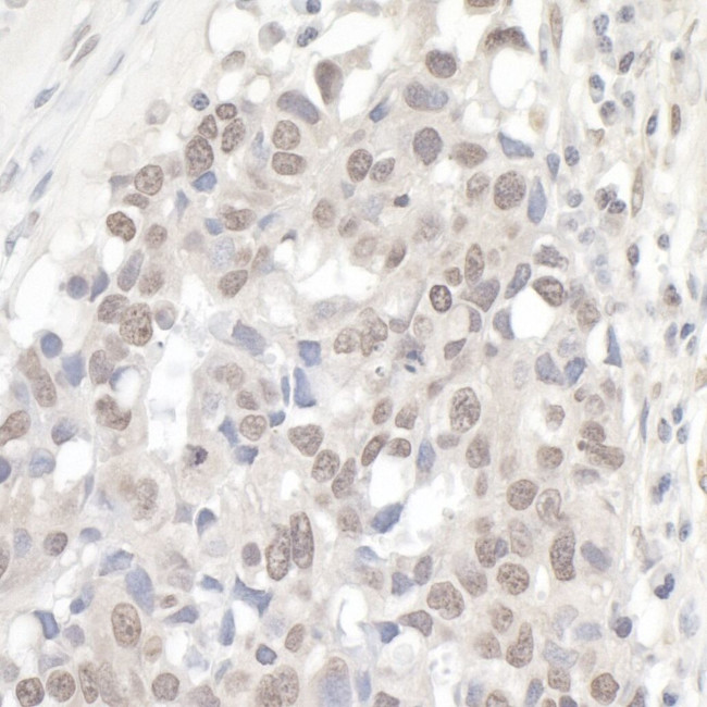 NCBP1/CBP80 Antibody in Immunohistochemistry (IHC)