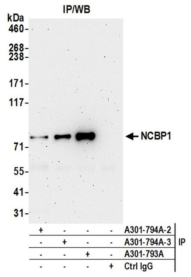 NCBP1/CBP80 Antibody in Western Blot (WB)