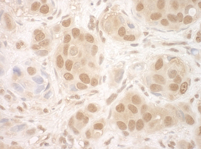 NCBP2 Antibody in Immunohistochemistry (IHC)