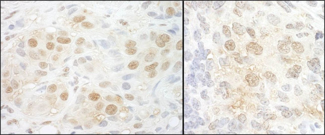 NCBP2 Antibody in Immunohistochemistry (IHC)