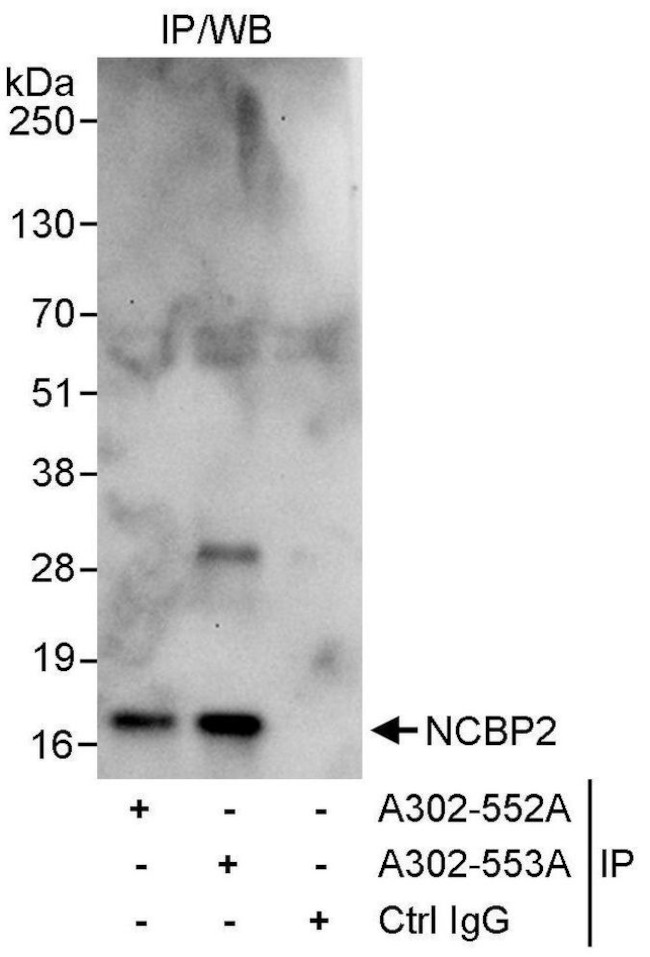 NCBP2 Antibody in Immunoprecipitation (IP)