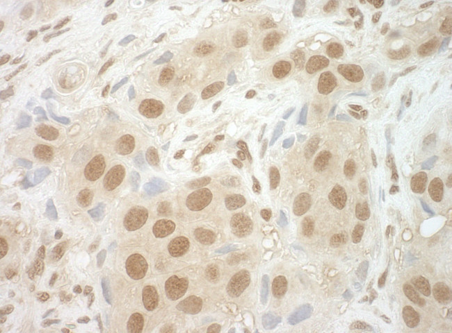 NCBP2 Antibody in Immunohistochemistry (IHC)