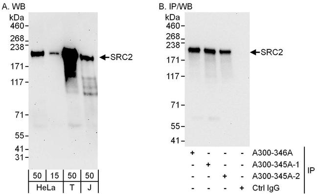 NCOA2/SRC2 Antibody in Western Blot (WB)