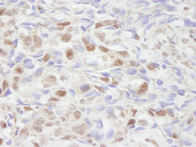 NCOA2/SRC2 Antibody in Immunohistochemistry (IHC)