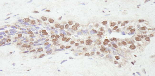 NCOA2/SRC2 Antibody in Immunohistochemistry (IHC)