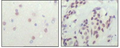 NCoR1 Antibody in Immunohistochemistry (Paraffin) (IHC (P))