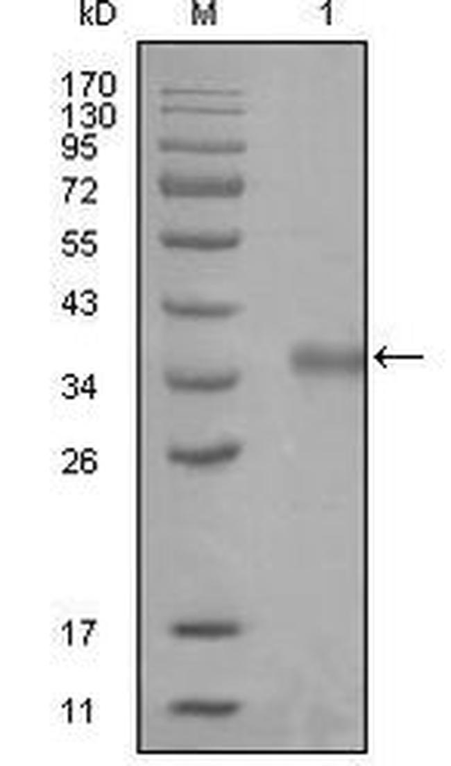 NCoR1 Antibody in Western Blot (WB)