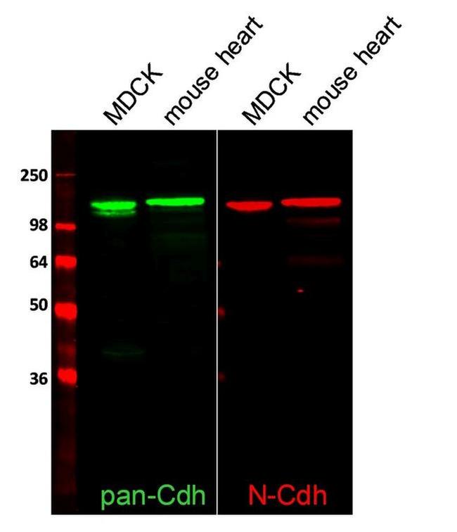 N-cadherin Antibody in Western Blot (WB)