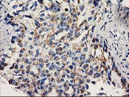 NDEL1 Antibody in Immunohistochemistry (Paraffin) (IHC (P))