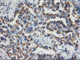 NDEL1 Antibody in Immunohistochemistry (Paraffin) (IHC (P))