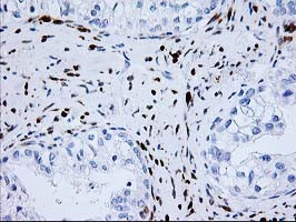 NDEL1 Antibody in Immunohistochemistry (Paraffin) (IHC (P))