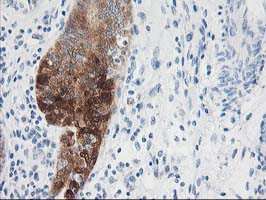 NDEL1 Antibody in Immunohistochemistry (Paraffin) (IHC (P))